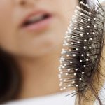 finire perdita capelli