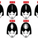 Cos’è la scala Ludwig? scala-ludwig